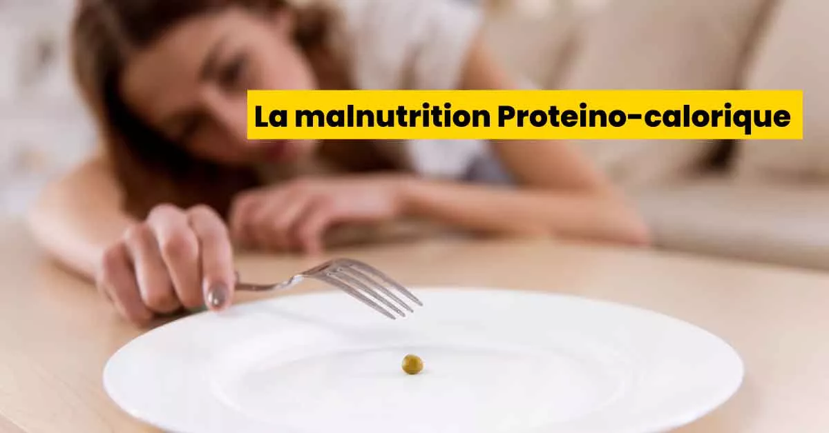 La malnutrition Proteino-calorique